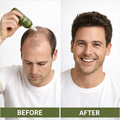 Lebanta Wonder Hair Growth Oil